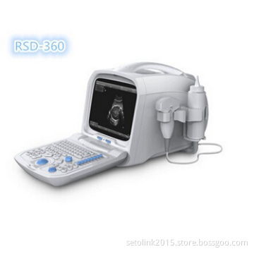 Portable Full Digital Ultrasound Scanner